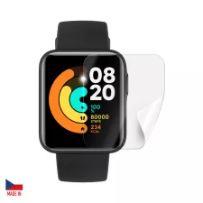 obrázek produktu Screenshield XIAOMI Redmi Watch 2 Lite folie na displej